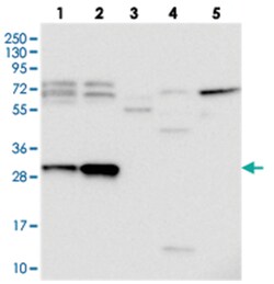 C15orf23, Rabbit, Polyclonal Antibody, Abnova 100 &mu;L | Buy Online | Abnova Corporation | Fisher Scientific