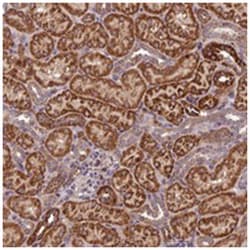 C15orf23, Rabbit, Polyclonal Antibody, Abnova 100 &mu;L | Buy Online | Abnova Corporation | Fisher Scientific