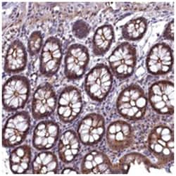 TMC5 Rabbit anti-Human, Polyclonal Antibody, Abnova 100 &mu;L | Buy Online | Abnova Corporation | Fisher Scientific