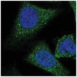 SIX5 Rabbit anti-Human, Polyclonal Antibody, Abnova 100&mu;L; Unlabeled:Antibodies,