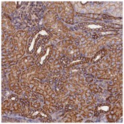 ZNF749 Rabbit anti-Human, Polyclonal Antibody, Abnova 100 &mu;L | Buy Online | Abnova Corporation | Fisher Scientific