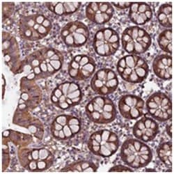 RINL Rabbit anti-Human, Polyclonal Antibody, Abnova 100 &mu;L | Buy Online | Abnova Corporation | Fisher Scientific