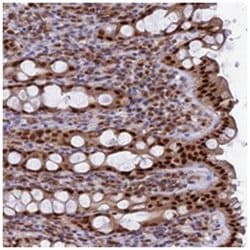 FAM118B Rabbit anti-Human, Polyclonal Antibody, Abnova 100 &mu;L | Buy Online | Abnova Corporation | Fisher Scientific