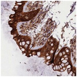ARRDC4 Rabbit anti-Human, Polyclonal Antibody, Abnova 100 &mu;L | Buy Online | Abnova Corporation | Fisher Scientific
