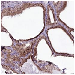 RSBN1, Rabbit, Polyclonal Antibody, Abnova 100 &mu;L | Buy Online | Abnova Corporation | Fisher Scientific