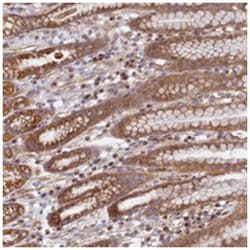 DDA1 Rabbit anti-Human, Polyclonal Antibody, Abnova 100&mu;L; Unlabeled:Antibodies,