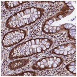 REXO1 Rabbit anti-Human, Polyclonal Antibody, Abnova 100&mu;L; Unlabeled:Antibodies,