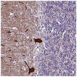 C9orf40, Rabbit, Polyclonal Antibody, Abnova 100 &mu;L | Buy Online | Abnova Corporation | Fisher Scientific