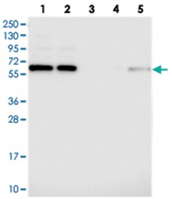 TCP11L2 Rabbit anti-Human, Polyclonal Antibody, Abnova 100&mu;L; Unlabeled:Antibodies,