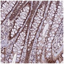 TCP11L2 Rabbit anti-Human, Polyclonal Antibody, Abnova 100&mu;L; Unlabeled:Antibodies,