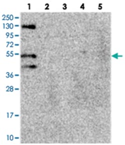 FUZ Rabbit anti-Human, Polyclonal Antibody, Abnova 100 &mu;L | Buy Online | Abnova Corporation | Fisher Scientific