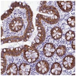 BRI3, Rabbit, Polyclonal Antibody, Abnova 100&mu;L; Unlabeled:Antibodies,