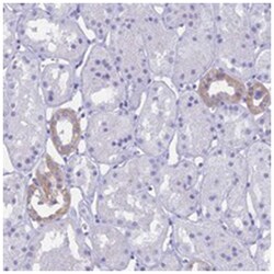 RP1, Rabbit, Polyclonal Antibody, Abnova 100&mu;L; Unlabeled:Antibodies,