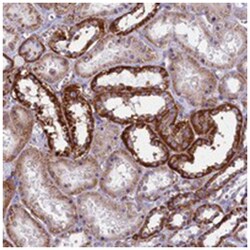 IL20RA Rabbit anti-Human, Polyclonal Antibody, Abnova 100 &mu;L | Buy Online | Abnova Corporation | Fisher Scientific