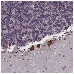 KCNE1L, Rabbit, Polyclonal Antibody, Abnova 100&mu;L; Unlabeled:Antibodies,