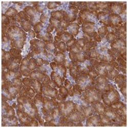 ST7L, Rabbit, Polyclonal Antibody, Abnova 100 &mu;L | Buy Online | Abnova Corporation | Fisher Scientific