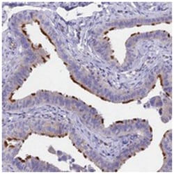 TMEM138, Rabbit, Polyclonal Antibody, Abnova 100&mu;L; Unlabeled:Antibodies,