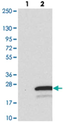 TMEM138, Rabbit, Polyclonal Antibody, Abnova 100&mu;L; Unlabeled:Antibodies,