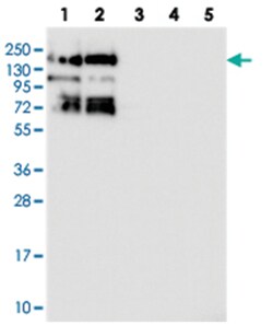 SBNO1, Rabbit, Polyclonal Antibody, Abnova 100 &mu;L | Buy Online | Abnova Corporation | Fisher Scientific