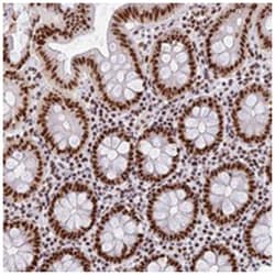 SBNO1, Rabbit, Polyclonal Antibody, Abnova 100 &mu;L | Buy Online | Abnova Corporation | Fisher Scientific
