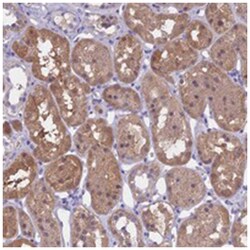 LHFPL2, Rabbit, Polyclonal Antibody, Abnova 100 &mu;L | Buy Online | Abnova Corporation | Fisher Scientific