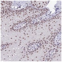 SETD2, Rabbit, Polyclonal Antibody, Abnova 100&mu;L; Unlabeled:Antibodies,