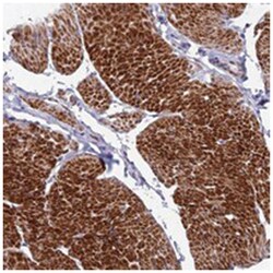 FAM178B, Rabbit, Polyclonal Antibody, Abnova 100 &mu;L | Buy Online | Abnova | Fisher Scientific