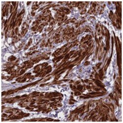 ENHO Rabbit anti-Human, Polyclonal Antibody, Abnova 100&mu;L; Unlabeled:Antibodies,