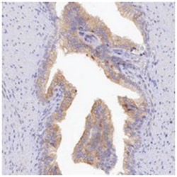 TCHHL1, Rabbit, Polyclonal Antibody, Abnova 100 &mu;L | Buy Online | Abnova | Fisher Scientific