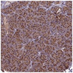 BANF2, Rabbit, Polyclonal Antibody, Abnova 100&mu;L; Unlabeled:Antibodies,