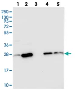CRIP2, Rabbit, Polyclonal Antibody, Abnova 100&mu;L; Unlabeled:Antibodies,