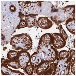 CRIP2, Rabbit, Polyclonal Antibody, Abnova 100&mu;L; Unlabeled:Antibodies,