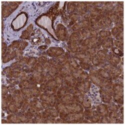 ANKRD39, Rabbit, Polyclonal Antibody, Abnova 100 &mu;L | Buy Online | Abnova | Fisher Scientific