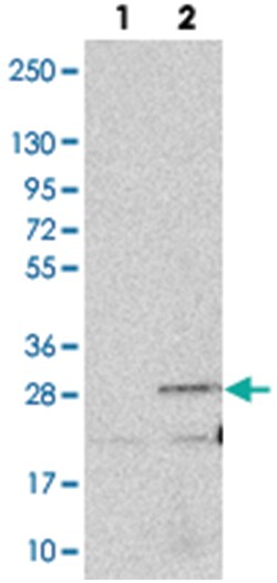ANKRD39, Rabbit, Polyclonal Antibody, Abnova 100 &mu;L | Buy Online | Abnova | Fisher Scientific