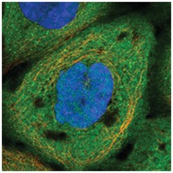 ARHGEF18, Rabbit, Polyclonal Antibody, Abnova 100&mu;L; Unlabeled:Antibodies,