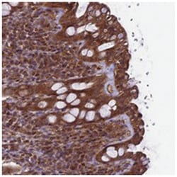 TTLL10, Rabbit, Polyclonal Antibody, Abnova 100&mu;L; Unlabeled:Antibodies,