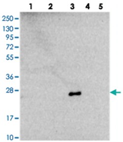NDUFB9 Rabbit anti-Human, Polyclonal Antibody, Abnova 100 &mu;L | Buy Online | Abnova | Fisher Scientific