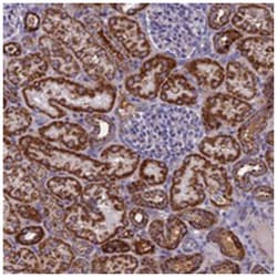 NDUFB9 Rabbit anti-Human, Polyclonal Antibody, Abnova 100 &mu;L | Buy Online | Abnova | Fisher Scientific