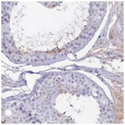 GPR123, Rabbit, Polyclonal Antibody, Abnova 100 &mu;L | Buy Online | Abnova Corporation | Fisher Scientific