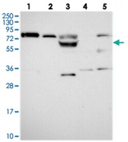 PODNL1, Rabbit, Polyclonal Antibody, Abnova 100 &mu;L | Buy Online | Abnova Corporation | Fisher Scientific