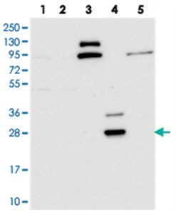 CYB561D2, Rabbit, Polyclonal Antibody, Abnova 100&mu;L; Unlabeled:Antibodies,