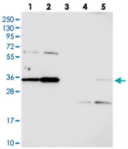 C3orf26, Rabbit, Polyclonal Antibody, Abnova 100 &mu;L | Buy Online | Abnova | Fisher Scientific