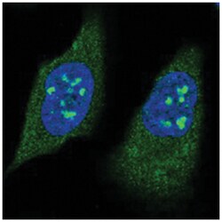 RPS19BP1, Rabbit, Polyclonal Antibody, Abnova 100&mu;L; Unlabeled:Antibodies,