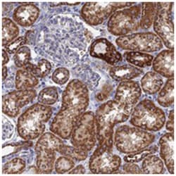 AQP11, Rabbit, Polyclonal Antibody, Abnova 100&mu;L; Unlabeled:Antibodies,