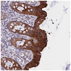 C16orf62, Rabbit, Polyclonal Antibody, Abnova 100&mu;L; Unlabeled:Antibodies,