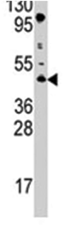 PRMT8, Rabbit, Polyclonal Antibody, Abnova 400 &mu;L | Buy Online | Abnova Corporation | Fisher Scientific