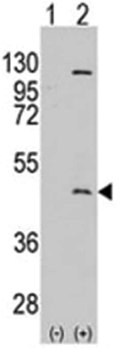 PRMT8, Rabbit, Polyclonal Antibody, Abnova 400 &mu;L | Buy Online | Abnova Corporation | Fisher Scientific