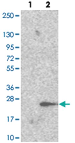 TRAPPC6A, Rabbit, Polyclonal Antibody, Abnova 100 &mu;L | Buy Online | Abnova Corporation | Fisher Scientific