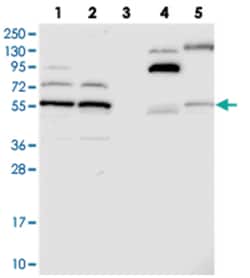 C5orf22, Rabbit, Polyclonal Antibody, Abnova 100 &mu;L | Buy Online | Abnova Corporation | Fisher Scientific