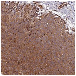 C5orf22, Rabbit, Polyclonal Antibody, Abnova 100 &mu;L | Buy Online | Abnova Corporation | Fisher Scientific